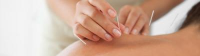 accupuncture nice 06