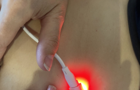 Photobiomodulation 