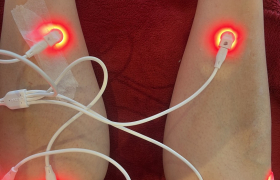 Photobiomodulation 