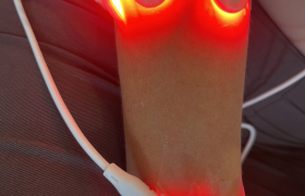 Photobiomodulation 