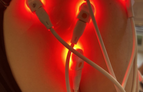 Photobiomodulation 